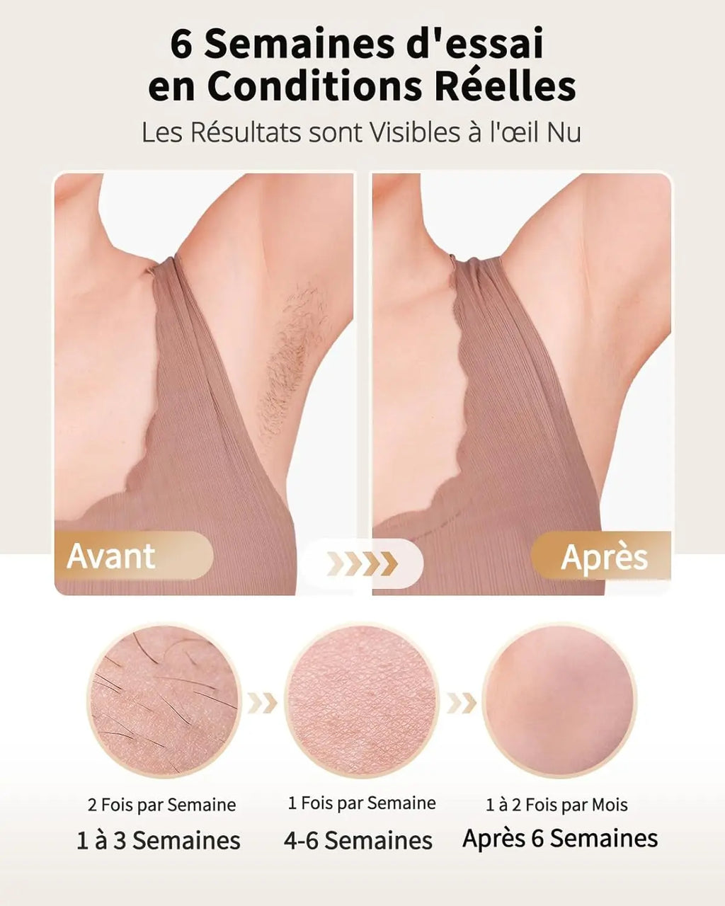 Ice-Cool IPL Laser Hair Removal – Unlimited Flashes, Painless & Long-Lasting Results