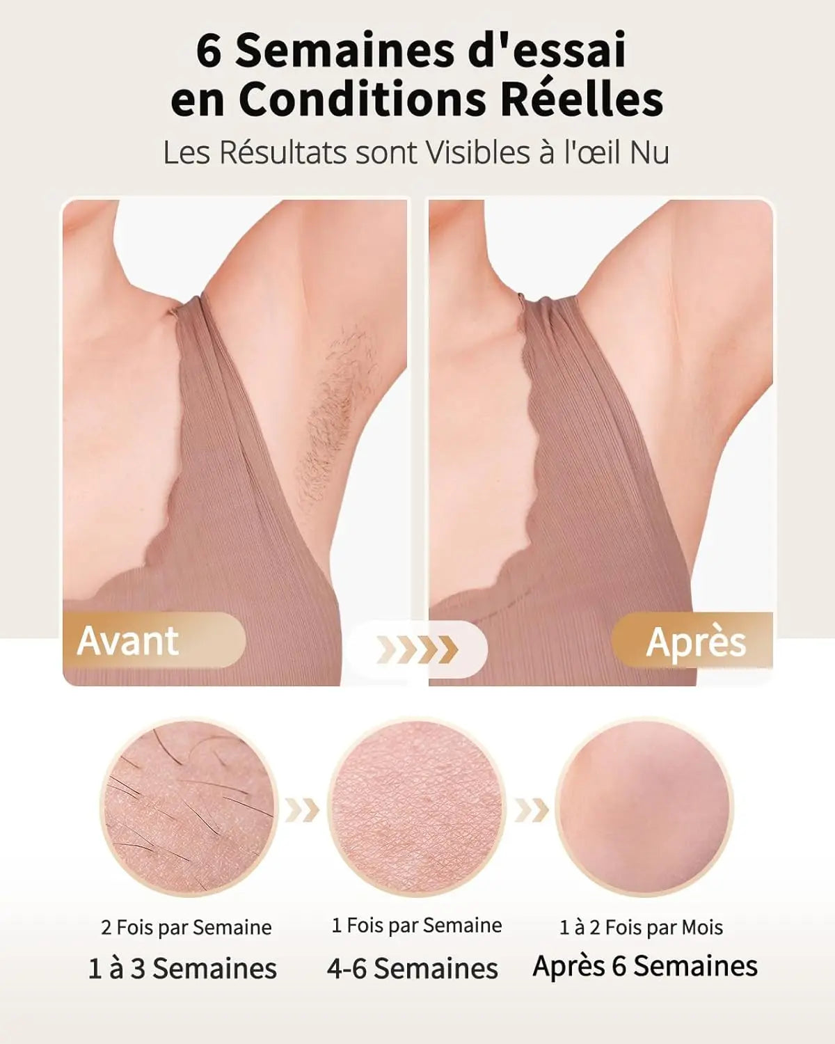 Ice-Cool IPL Laser Hair Removal – Unlimited Flashes, Painless & Long-Lasting Results