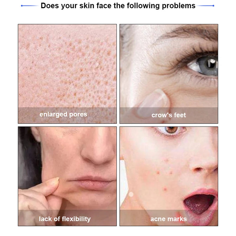 V-Lift Miracle Mask™ — Firming & Hydrating Face Kit (Peptides + Hyaluronic Acid)