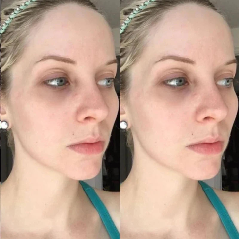 V-Lift Miracle Mask™ — Firming & Hydrating Face Kit (Peptides + Hyaluronic Acid)